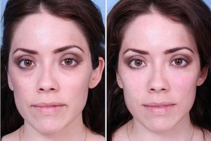 5 Советов, как правильно ухаживать за кожей вокруг глаз